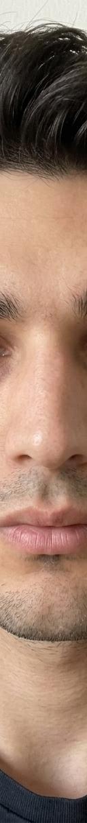 Original photo before