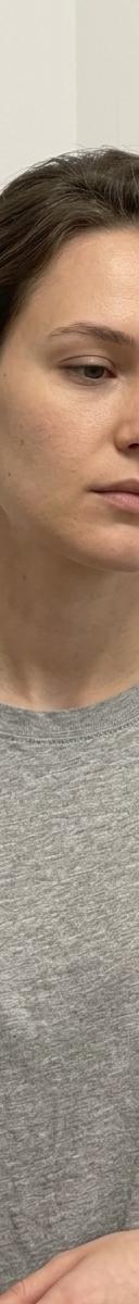 Original photo before
