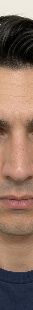 Original photo before