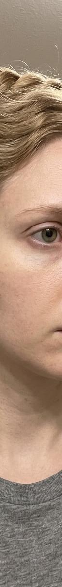 Original photo before