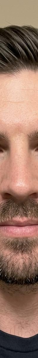 Original photo before