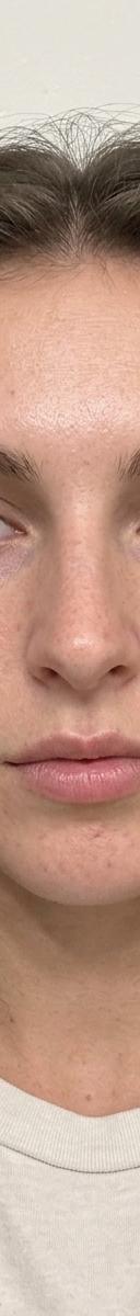Original photo before