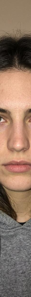 Original photo before
