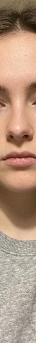 Original photo before